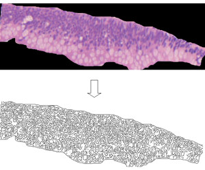 Figure 1.0.25-mm length colonic mucosa sample (top) and its skeletonized contours obtained by a canny edge filter (bottom). About 300 microstructures are revealed (nuclei, mucin droplets, vacuoles).
