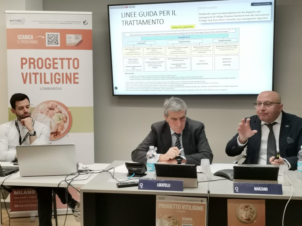 Vitiligine In Lombardia Oltre 60mila Persone Convivono Con La Malattia