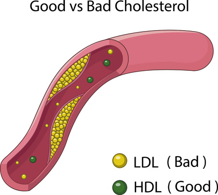 Probiotici ‘amici del cuore’ aiutano a combattere il colesterolo cattivo partendo dall'equilibrio dell'intestino