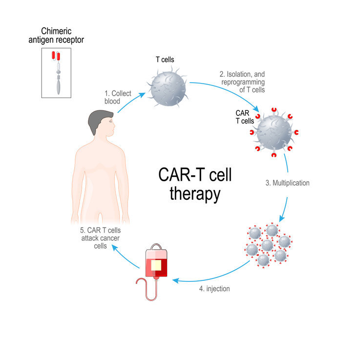 Car T Cell 1