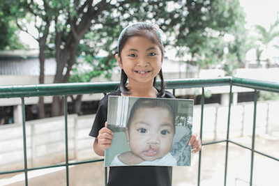 GSK Consumer Healthcare partner di Smile Train per aiutare i bambini affetti da labiopalatoschisi