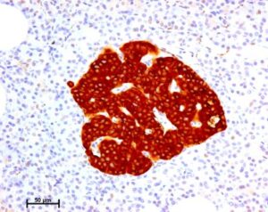 Autotrapianto Di Isole Pancreatiche: Pubblicati I Risultati Di Uno Studio Del San Raffaele E Di Humanitas, Sull’efficacia Della Procedura In Pazienti Sottoposti A Pancreasectomia.