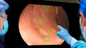 Intelligenza Artificiale In Gastroenterologia: Progressi E Risparmi Nella Tecnica Diagnostica