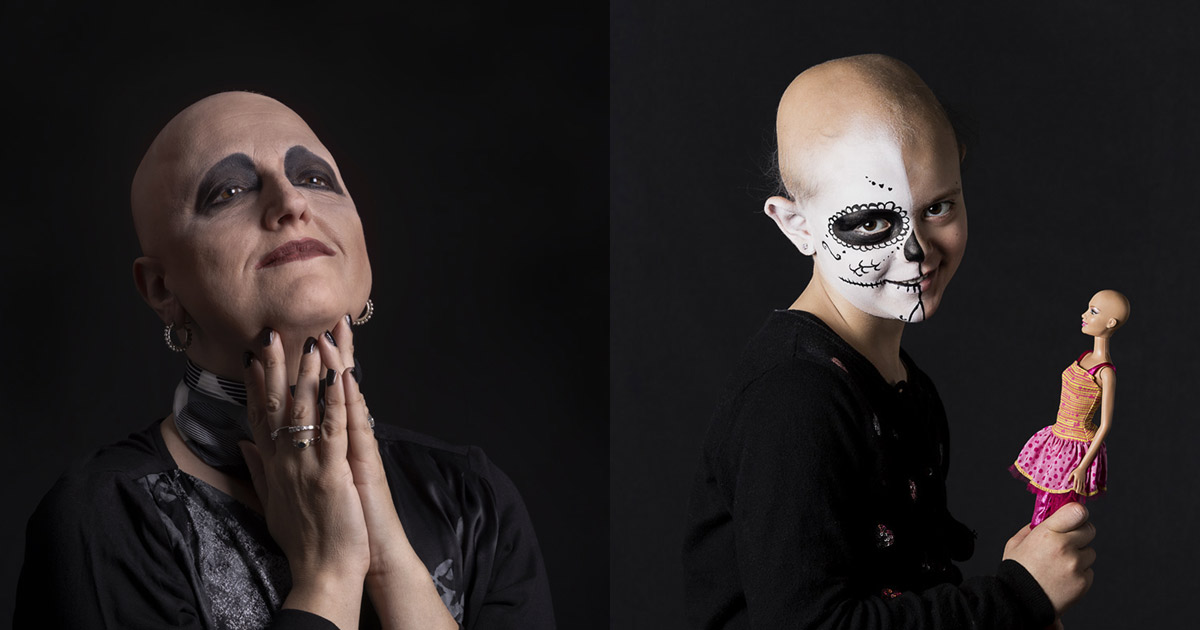 “mettiti Nei Miei Panni” – Alopecia Aerata Raccontata Attraverso Scatti D’autore In Una Mostra Fotografica Per Sensibilizzare Ad Una Patologia Ancora Oggi Tabù