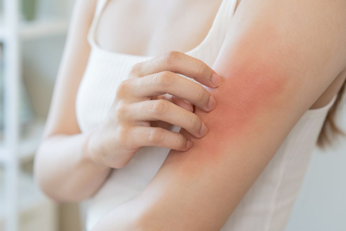 Beauty, In Autunno Prurito, Acne, Secchezza Colpiscono 7 Persone Su 10 Solo Uk : Dagli Esperti Ecco Le Soluzioni Di Skin Care Più Efficaci