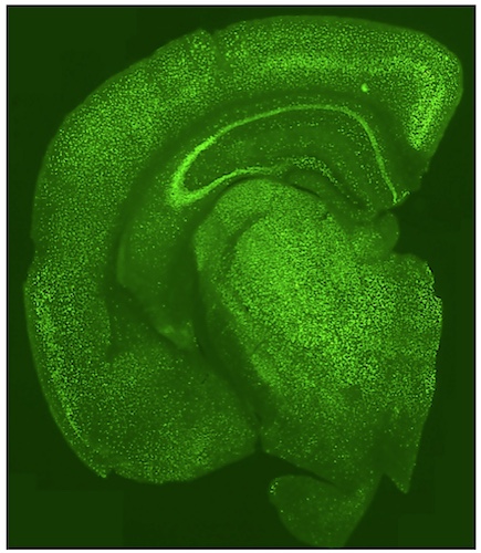 san-raffaele-mi-cnr-brain-mecp2