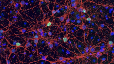 san-raffaele-mi-cnr-mecp2in-neuroniinvitro