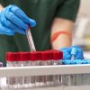 Beta Talassemia Trasfusione dipendente