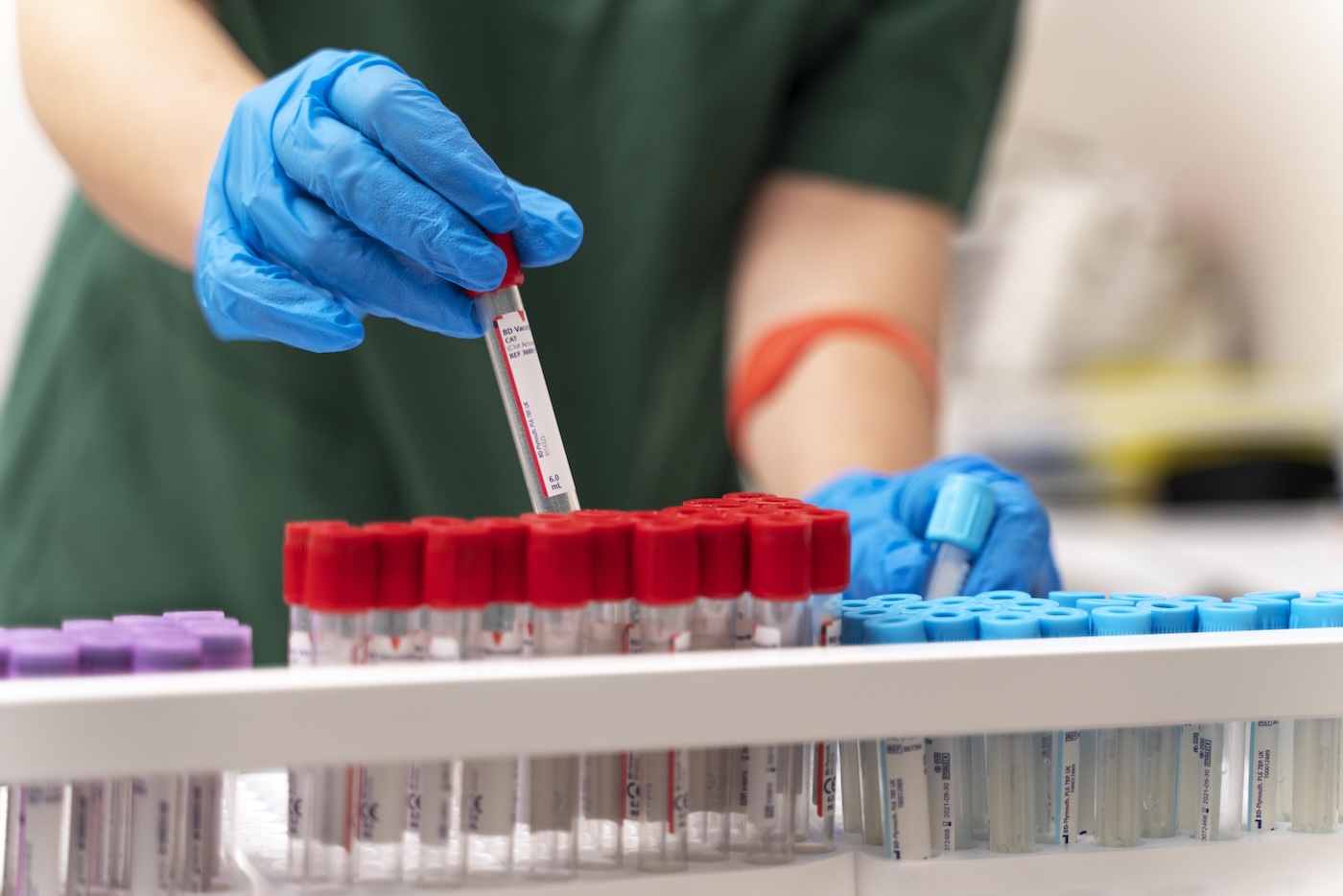 Al via un nuovo studio clinico di terapia genica per pazienti con beta-talassemia trasfusione-dipendente